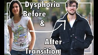 Gender Dysphoria Before amp After Transitioning [upl. by Danya]