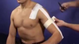 AC acromioclavicular Joint Taping Technique [upl. by Aehcim567]