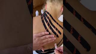 Lymphatic correction in the acute stage after cervical spine contusion [upl. by Kenley]