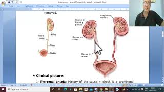 Urosurgery in Arabic 17 Anuria  part 1   by Dr Wahdan [upl. by Ebert]