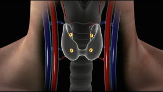 Overview of Parathyroid Disease Causes Symptoms and Treatment for Hyperparathyroidism [upl. by Seem]