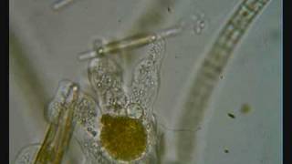 Amoeba engulfing diatom [upl. by Stahl360]