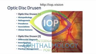 Optic Disc Drusen Part 1 Preview [upl. by Bullion]