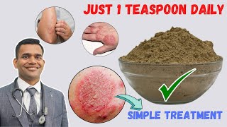 Just 1 Teaspoon Daily To Cure all Your Skin Problems  Eczema  Simple Treatment [upl. by Thorvald722]