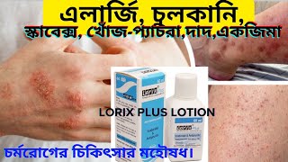 এলার্জি চুলকানি শেষ হবে এক দিনে  Lorix plus lotion Scabex [upl. by Irahk]