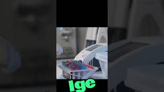 what is IGE immunoglobulin E IGE [upl. by Zannini]