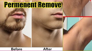 Permanent Hair Removal Laser Price in Pakistan  Cost Benefits Side Effects Clinics and Results [upl. by Asereht]