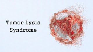 Tumor Lysis Syndrome Oncologic Emergencies [upl. by Sicnarf]