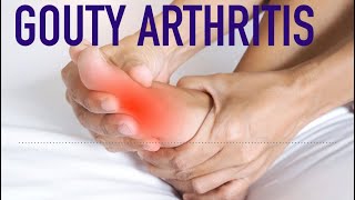 Gouty Arthritis [upl. by Hull355]