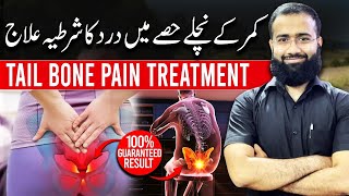 Tailbone Pain Treatment  Coccyx Pain Relief Exercises [upl. by Nicoli]