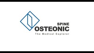 Osteonic Spine System is newly coming [upl. by Frasco]