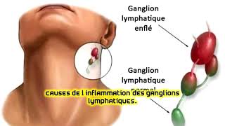 Causes de l’inflammation des ganglions lymphatiques [upl. by Okimuk]