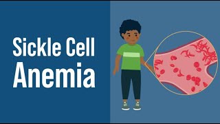 Sickle Cell Anemia [upl. by Crystal577]