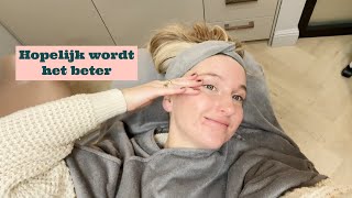 ACNE BEHANDELING FAVO HEMA ITEMS amp UITETEN  VITA CLEO VLOG 148 [upl. by Lipson]