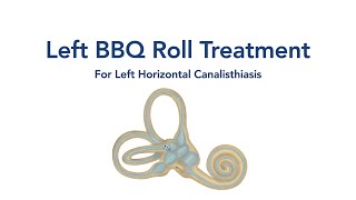 At Home Left BBQ Roll Treatment for BPPV Vertigo [upl. by Aerb]