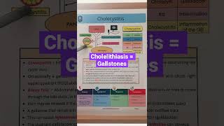 🔥 SIMPLE DIAGRAM  Gallbladder Symptoms amp Pain in 60 SECONDS Gallstones Explained [upl. by Dahlia]