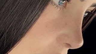 virtual plastic surgery ★ ski sloped nose within seconds ୨୧ rhinoplasty effect 🪡  ° ☆ [upl. by Cilegna]