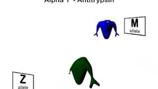 Alpha 1 Antitrypsin Deficiency [upl. by Werdnaed]