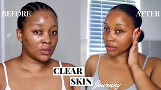 NIGHTTIME SKINCARE  clearing my acne  dark spots with a Skin Cycling Routine [upl. by Isidora224]