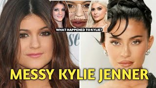 KYLIE JENNER DID PLASTIC SURGERY TO LOOK MORE TO WIN FANS OVER [upl. by Yedoc721]