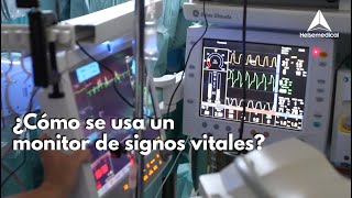 ¿Cómo se usa un monitor de signos vitales [upl. by Munroe]