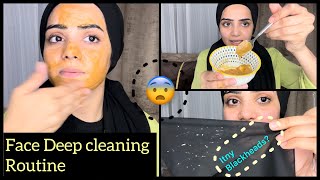 This Is How I Remove My Blackheads On Face  💯 Live Results Dietitian Aqsa [upl. by Betteanne27]