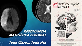 Resonancia Magnética Cerebral Conceptos básicos Todo claro Todo Rico [upl. by Hodges]