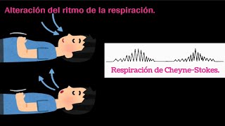 Respiración de CheyneStokes [upl. by Mirth]