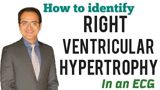 Right Ventricular Hypertrophy RVH ECG Explained ECG Lectures USMLE NEET Pg [upl. by Gally58]