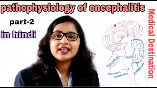 Encephalitis part2  pathophysiology  symptoms  treatment in hindi  medical Destination [upl. by Benn]