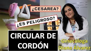 CIRCULAR DE CORDON POR GINECOLOGA DIANA ALVAREZ [upl. by Novyart102]