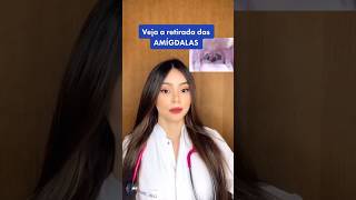 AMIGDALECTOMIA COMO É A CIRURGIA DE RETIRADA DAS AMÍDALAS [upl. by Ahselak486]