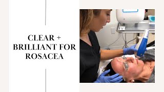 Clear  Brilliant for Rosacea  Live [upl. by Llenwahs]