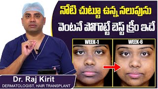 నోటిచుట్టూ నలుపు పోవాలంటే  How to Remove Pigmentation Around Mouth Naturally  Celestee Skin Clinic [upl. by Edgar]