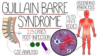 Guillain Barre Syndrome Explained Clearly Including Subtypes [upl. by Enitsahc]