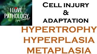 Cell Adaptations pathologyHYPERTROPHY HYPERPLASIA AND METAPLASIA [upl. by Archambault]