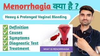 Menorrhagia in Hindi  Causes Symptoms And Treatment of Menorrhagia [upl. by Orhtej]