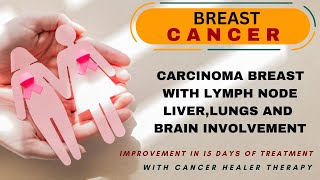 Carcinoma Breast with lymph node liver lungs and brain involvement  Cancer Healer Center [upl. by Reede]