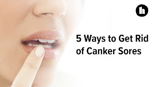 5 Ways to Get Rid of Canker Sores  Healthline [upl. by Ebaj]