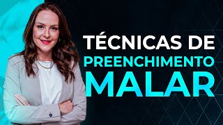 Live 026  Técnicas de preenchimento Malar [upl. by Oirogerg]