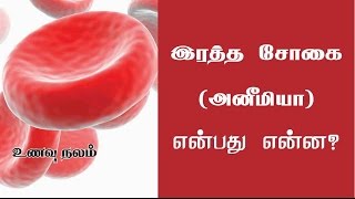 இரத்த சோகையை தடுக்கும் உணவுகள் – Anemia Foods [upl. by Eylhsa]