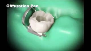 Root canal treatment and Cap [upl. by Zerlina]