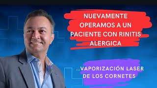 Otro cirugía de cornetes con láser Paciente con rinitis alergica [upl. by Jephum]