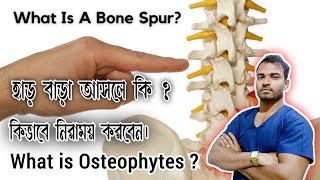 হাড় বাড়া আসলে কি  What is Osteophytes What is Bone spur [upl. by Korff666]