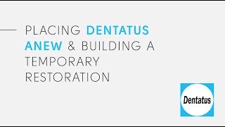 Dentatus ANEW Placement amp Building A Temporary Restoration [upl. by Koah]