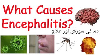 Encephalitis causes symptoms treatmentinflammation in brainDr hafiz Abdul sattar anjumUrduHindi [upl. by Anavas]