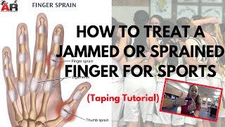 How To Treat a Jammed or Sprained Finger For Sports [upl. by Htezzil236]