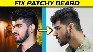 How to fix your PATCHY BEARD at Home  4 steps ExpertsKiSuno [upl. by Pepper]