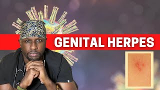 The Truth About Genital Herpes Complete Guide [upl. by Yesdnil517]