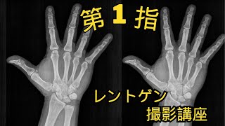 【新人放射線技師、医学生必見！】放射線技師による、レントゲンの撮りかた講座～第1指の一般撮影～ [upl. by Nawj300]